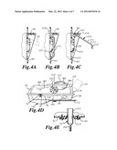 Boat lift drive housing apparatus diagram and image