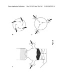 Carbon Conversion System with Integrated Processing Zones diagram and image