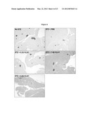 TISSUE KALLIKREIN FOR THE TREATMENT OF PANCREATIC Beta-CELL DYSFUNCTION     AND FOR Beta-CELL PROLIFERATION diagram and image