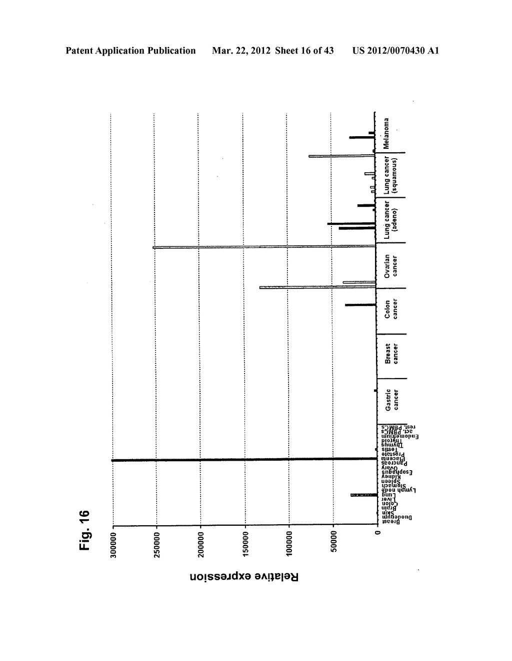 IDENTIFICATION OF TUMOR-ASSOCIATED MARKERS FOR DIAGNOSIS AND THERAPY - diagram, schematic, and image 17