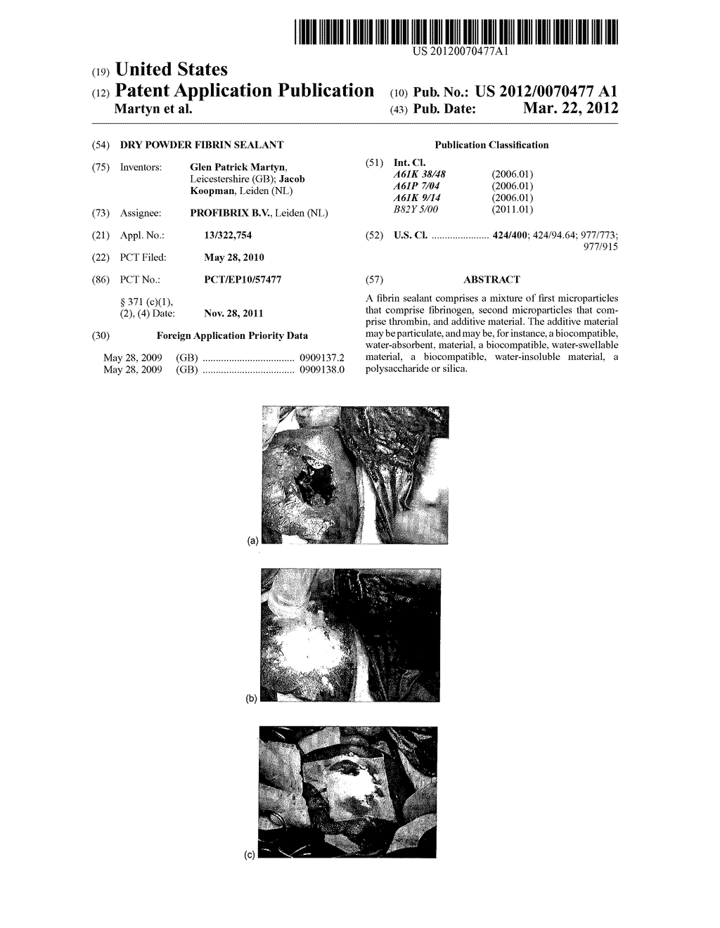 DRY POWDER FIBRIN SEALANT - diagram, schematic, and image 01