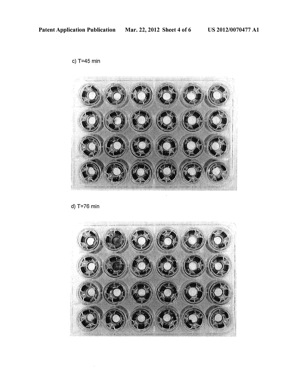 DRY POWDER FIBRIN SEALANT - diagram, schematic, and image 05