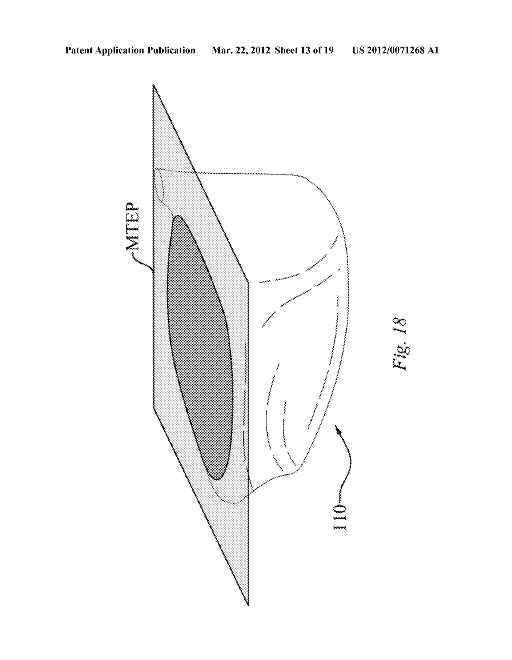 HIGH VOLUME AERODYNAMIC GOLF CLUB HEAD HAVING A POST APEX ATTACHMENT     PROMOTING REGION - diagram, schematic, and image 14