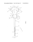 LACROSSE HEAD WITH DIFFERENTIATED BALL STOP diagram and image