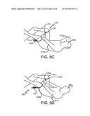 Exercise Device diagram and image