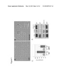 METHODS OF INHIBITING CANCER CELL GROWTH WITH HDAC INHIBITORS AND METHODS     OF SCREENING FOR HDAC10 INHIBITORS diagram and image