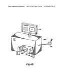 FORCE FEEDBACK CONTROL SYSTEM FOR VIDEO ENDOSCOPE diagram and image