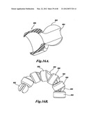 FORCE FEEDBACK CONTROL SYSTEM FOR VIDEO ENDOSCOPE diagram and image