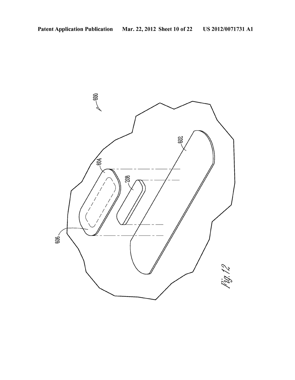 SYSTEM AND METHOD FOR PHYSIOLOGICAL MONITORING - diagram, schematic, and image 11