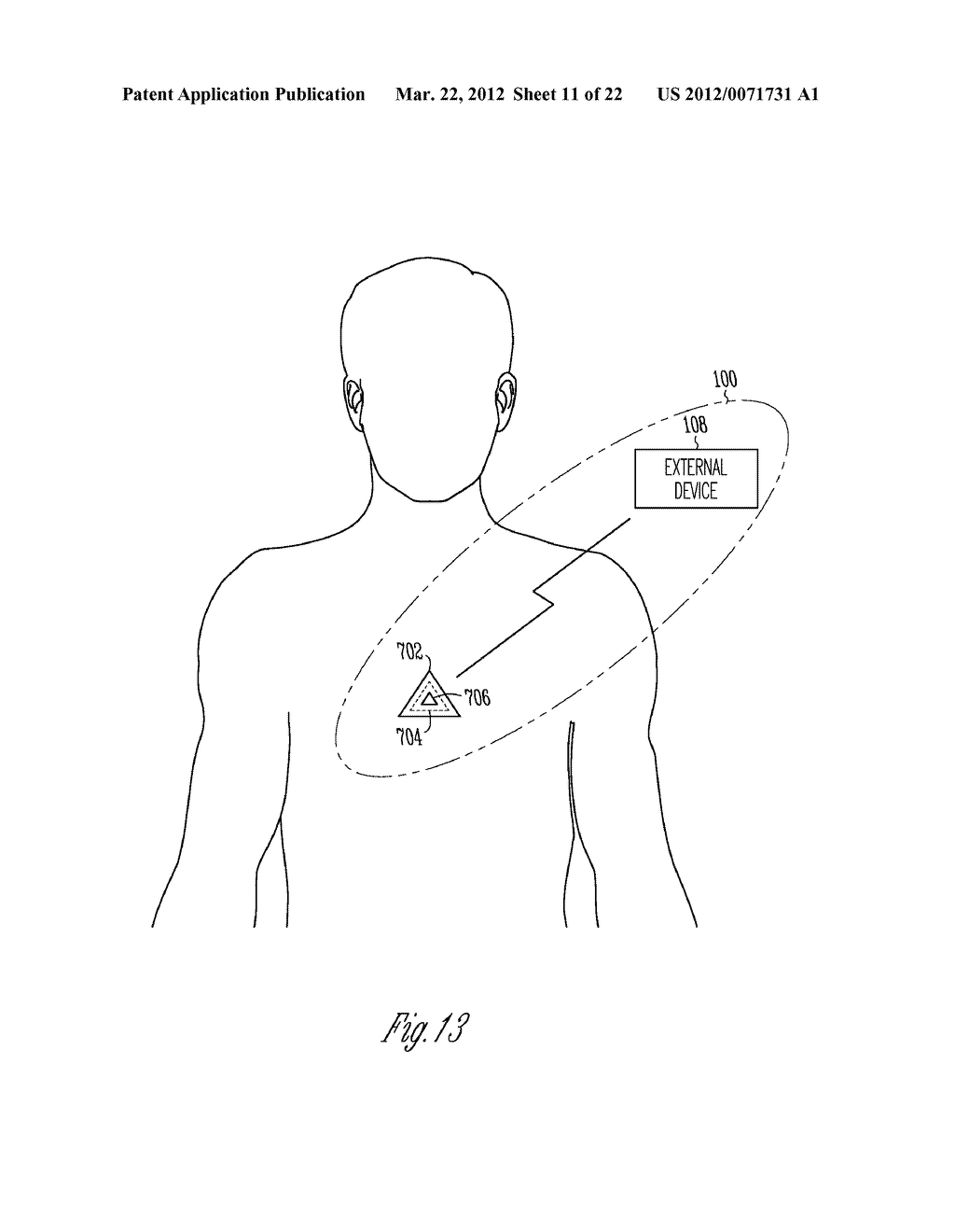 SYSTEM AND METHOD FOR PHYSIOLOGICAL MONITORING - diagram, schematic, and image 12