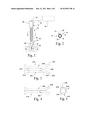 Instruments and Methods for Nerve Monitoring in Spinal Surgical Procedures diagram and image
