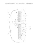 OCULAR IMPLANT SYSTEMS diagram and image