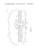 OCULAR IMPLANT SYSTEMS diagram and image