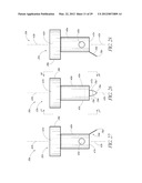 OCULAR IMPLANT SYSTEMS diagram and image