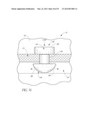 OCULAR IMPLANT SYSTEMS diagram and image