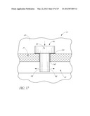 OCULAR IMPLANT SYSTEMS diagram and image