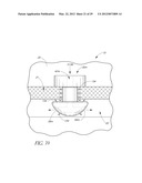 OCULAR IMPLANT SYSTEMS diagram and image