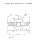 OCULAR IMPLANT SYSTEMS diagram and image