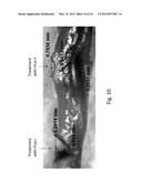 DIODE LASER SYSTEMS AND METHODS FOR ENDOSCOPIC TREATMENT OF TISSUE diagram and image