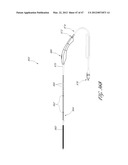 SYSTEMS FOR TREATING A HOLLOW ANATOMICAL STRUCTURE diagram and image