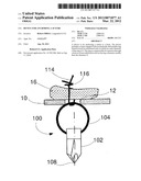 Device for Anchoring a Suture diagram and image