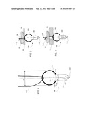 Device for Anchoring a Suture diagram and image