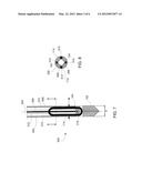 Device for Anchoring a Suture diagram and image