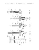 Device for Anchoring a Suture diagram and image