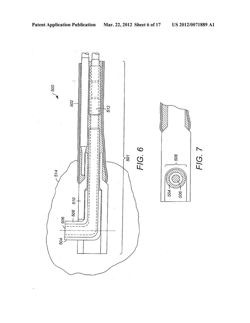 RADIALLY-FIRING ELECTROHYDRAULIC LITHOTRIPSY PROBE - diagram, schematic, and image 07