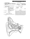 METHOD AND APPARTUS FOR COCHLEAR IMPLANT SURGERY diagram and image