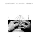 METHOD AND APPARATUS FOR HAND GESTURE CONTROL IN A MINIMALLY INVASIVE     SURGICAL SYSTEM diagram and image