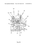 METHOD AND APPARATUS FOR HAND GESTURE CONTROL IN A MINIMALLY INVASIVE     SURGICAL SYSTEM diagram and image