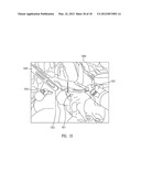 METHOD AND SYSTEM FOR HAND PRESENCE DETECTION IN A MINIMALLY INVASIVE     SURGICAL SYSTEM diagram and image