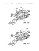 ANTI-BUCKLING MECHANISMS AND METHODS diagram and image