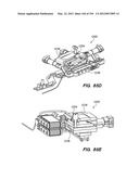 ANTI-BUCKLING MECHANISMS AND METHODS diagram and image