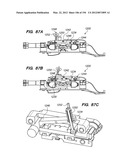 ANTI-BUCKLING MECHANISMS AND METHODS diagram and image