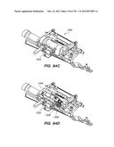 ANTI-BUCKLING MECHANISMS AND METHODS diagram and image