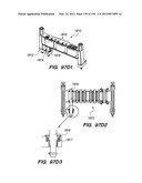 ANTI-BUCKLING MECHANISMS AND METHODS diagram and image