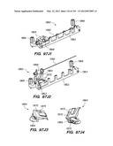 ANTI-BUCKLING MECHANISMS AND METHODS diagram and image