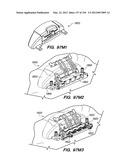 ANTI-BUCKLING MECHANISMS AND METHODS diagram and image