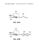 ANTI-BUCKLING MECHANISMS AND METHODS diagram and image