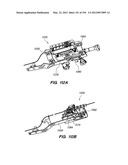 ANTI-BUCKLING MECHANISMS AND METHODS diagram and image