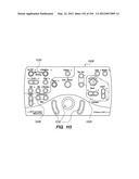 ANTI-BUCKLING MECHANISMS AND METHODS diagram and image