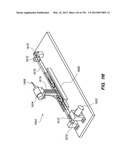 ANTI-BUCKLING MECHANISMS AND METHODS diagram and image