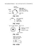 ANTI-BUCKLING MECHANISMS AND METHODS diagram and image