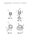 ANTI-BUCKLING MECHANISMS AND METHODS diagram and image