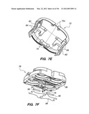 ANTI-BUCKLING MECHANISMS AND METHODS diagram and image