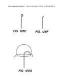 ANTI-BUCKLING MECHANISMS AND METHODS diagram and image