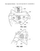 ANTI-BUCKLING MECHANISMS AND METHODS diagram and image