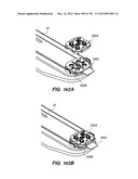 ANTI-BUCKLING MECHANISMS AND METHODS diagram and image